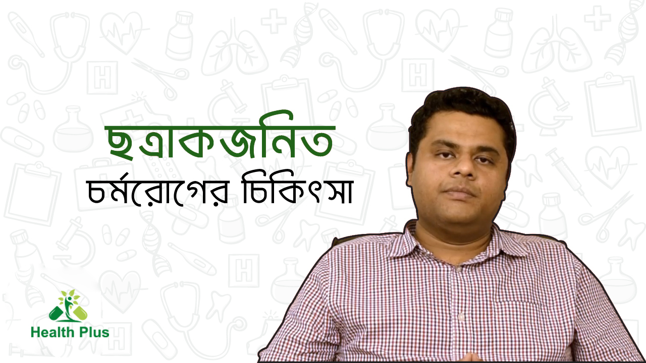 ছত্রাকজনিত চর্মরোগের চিকিৎসা